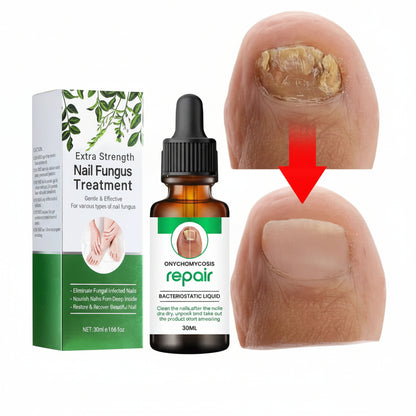 Nail Serum for Nail Repair for Damage, Growth, Fungle Infaction (Pack Of 2)