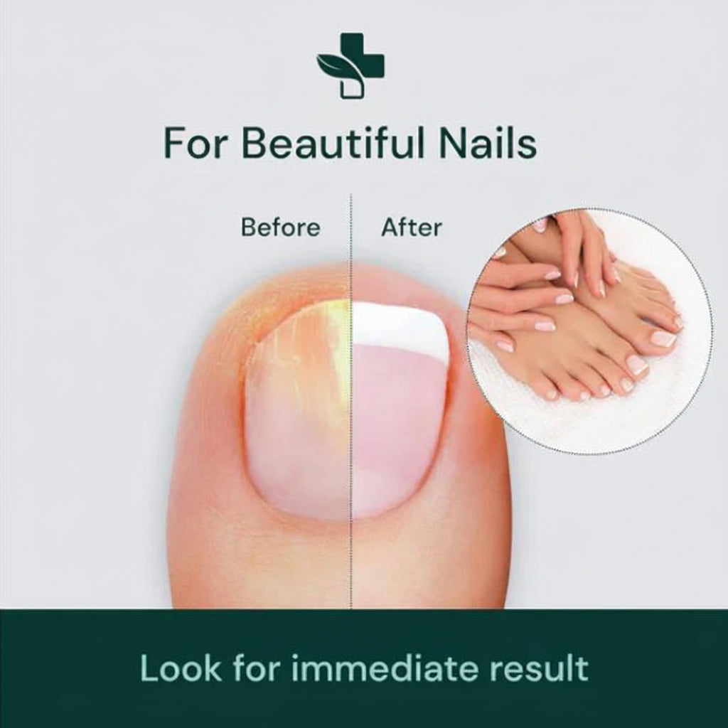 Nail Serum for Nail Repair for Damage, Growth, Fungle Infaction (Pack Of 2)